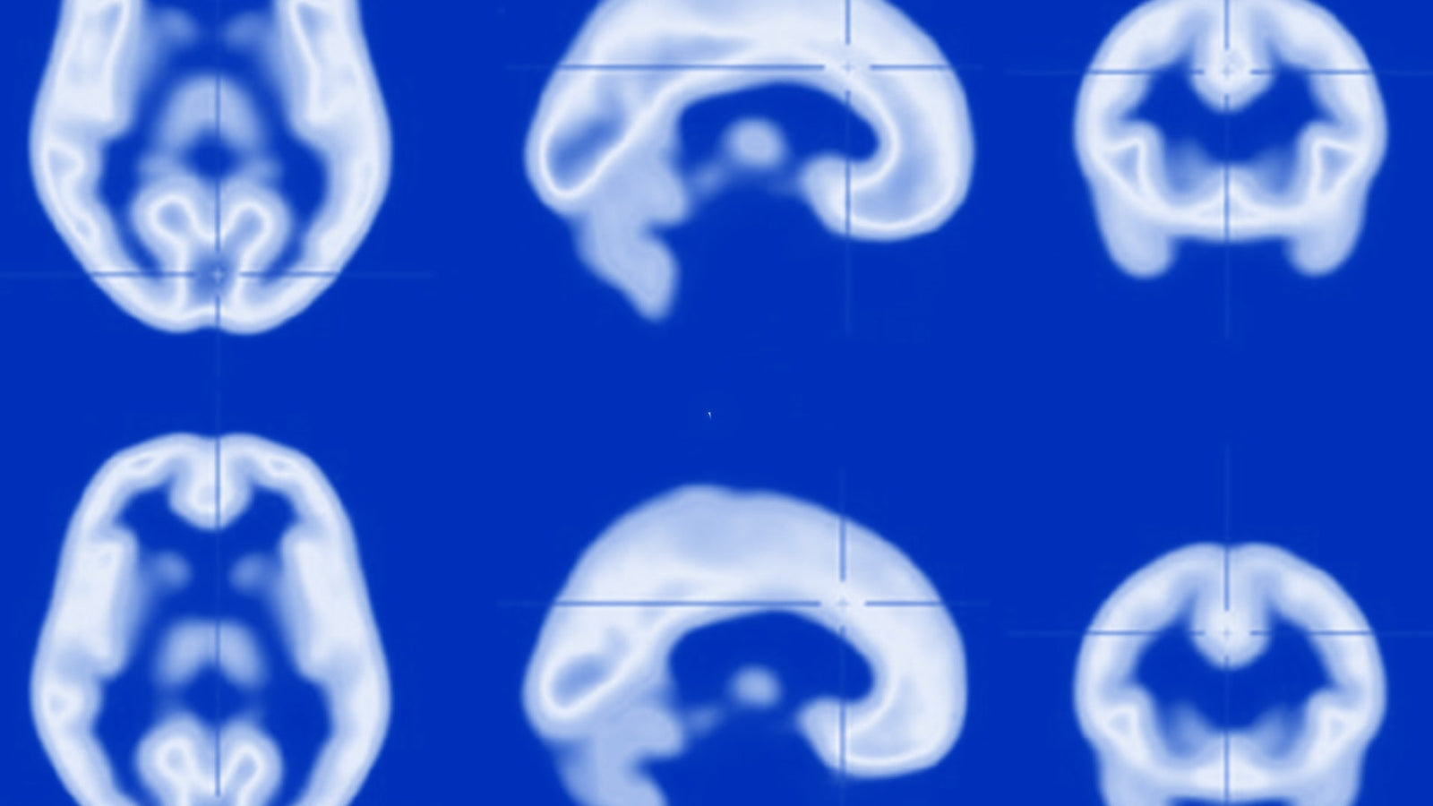 Your Brain’s Chill Switch: A Guide to GABA Receptors